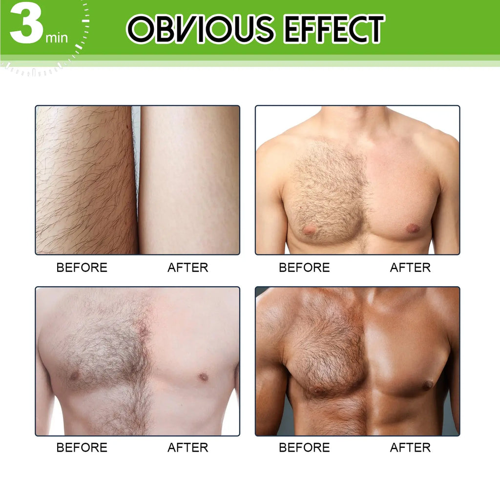 East Moon Hair Removal Cream For Men, Arms, Armpits And Legs Gentle And Non-Irritating Body Clean Skin Hair Removal Cream eprolo