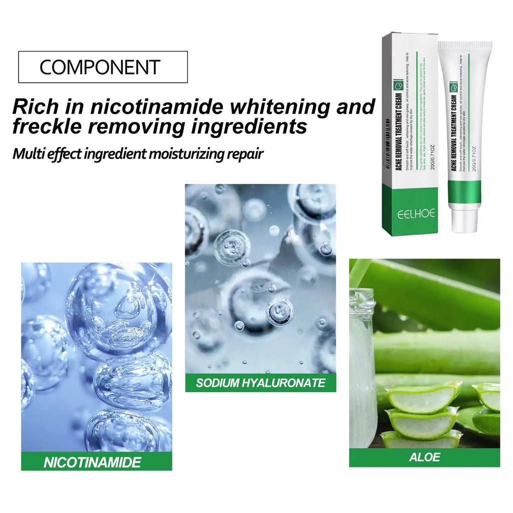EELHOE Skin Care Cream Improves Dull Skin, Moisturizes Skin, Brightened Skin Care Cream And Clears Acne eprolo