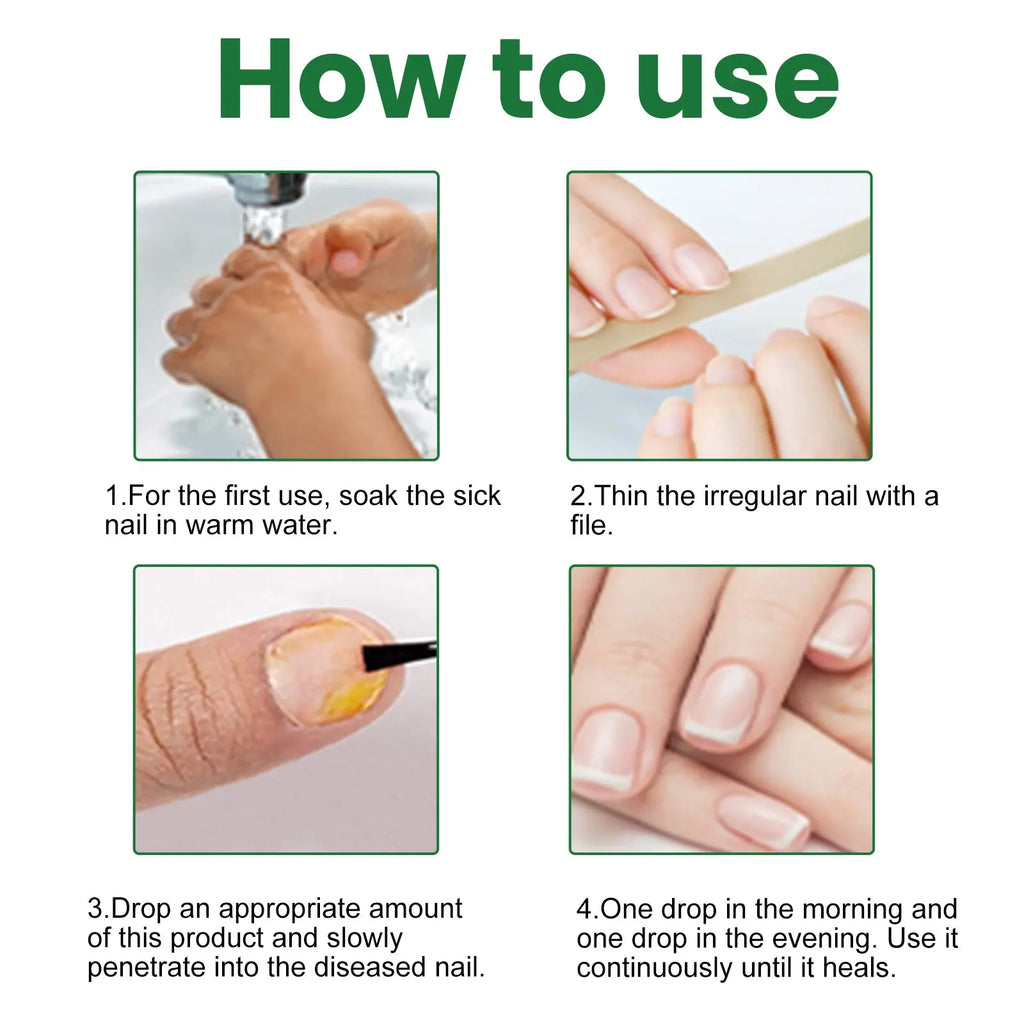 EELHOE Gray Nail Repair Remove Gray Nail Nourishing Lotion, Brightening Soft Nails Moisturizing Nail Care Solution For Hands, Feet And Nails eprolo